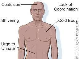 hypothermia